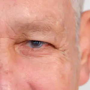 close-up of an elderly man's eye with fine lines and wrinkles