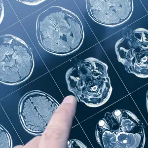 A hand is pointing at an MRI brain scan image on a blue background, divided into nine sections, showing different brain structures and sections.
