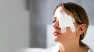 Woman with bandages over her eye after surgery
