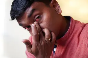 Man with a red eye and hand on his face