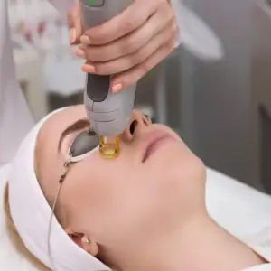 Woman undergoing laser treatment for wrinkles on her face.
