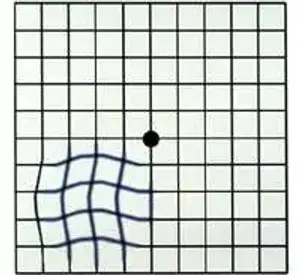 Image of a grid with a blue distortion pattern in the lower left quadrant and a black dot in the center
