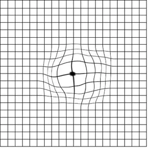 Graph displaying a central point with intersecting lines forming a grid pattern