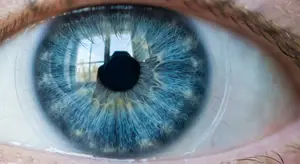 Close up of a blue eye with a contact lens.