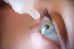 A person applying eye drops to their left eye, focusing on the eye and the dropper bottle.