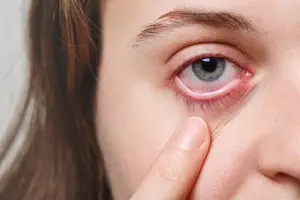 A close-up of a woman's face with her finger on her eye, possibly trying to remove something from her eye.