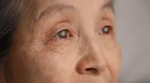 Close up of a senior woman with cataracts looking into the camera