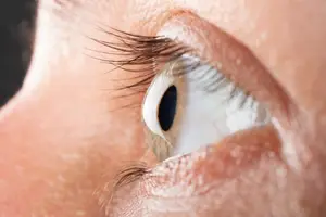 Contact lenses for Keratoconus in Greater New Haven