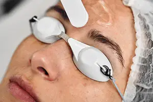 A woman is having her eyebrows waxed with a white eyebrow waxing device.