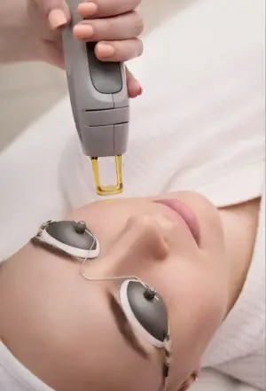 A woman wearing protective eye goggles is receiving a laser treatment on her face by a person holding a laser device.