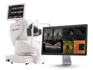 OCT image showing retinal layers and blood vessels