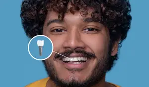 A smiling man with curly hair and a beard shows a dental implant in his mouth.