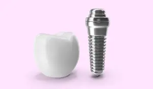 A white tooth model next to a silver dental implant on a pink background