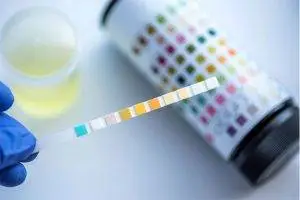 A person wearing blue gloves is holding a urine test strip near a yellow liquid in a cup and a test strip container with various colors.