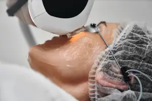 Close up of a woman getting a laser treatment on her neck