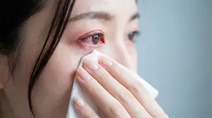 A woman is wiping her eyes with a tissue, likely due to allergies.