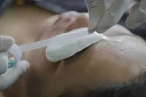 Close up of a person's face receiving a facial treatment from a professional in a clinic.