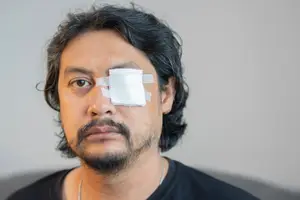 A man with a bandage on his right eye and wearing a black shirt.