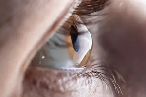 Close-up of a human eye with a visible tear on the cornea.