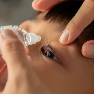 A person is applying eye drops to a child's eye.