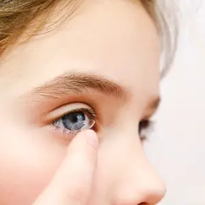 A close-up of a young girl's face with a contact lens in her eye.