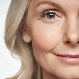 Close-up of a woman's face with wrinkles on her forehead and around her eyes