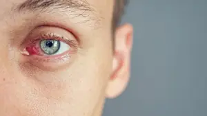 A close-up of a man's eye with a red spot, looking serious and staring at something