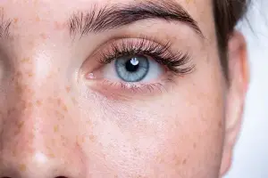 A close-up view of a woman's face with blue eyes, freckles, and a white background