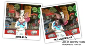 Illustration of a pig chef with normal vision on the left and with macular degeneration on the right.