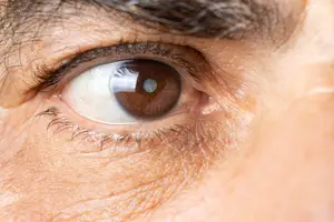 Close up of a human eye with brown iris and white sclera
