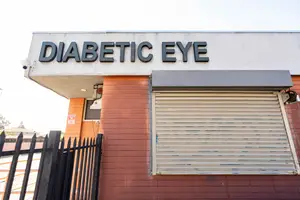 A sign reading Diabetic Eye above a window with a metal gate