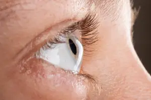 Close-up of a person's eye with a contact lens inserted