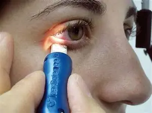 A person is getting their eye checked with a blue medical device.