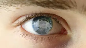 Close up of a person's eye with a reflection of a cloud in the iris.